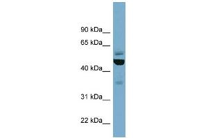 WB Suggested Anti-TUBE1 Antibody Titration: 0. (TUBE1 Antikörper  (Middle Region))