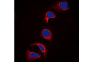 Immunofluorescent analysis of c-CBL (pY700) staining in HeLa cells. (CBL Antikörper  (C-Term, pTyr700))