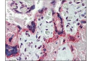 Human Placenta: Formalin-Fixed, Paraffin-Embedded (FFPE) (MMP3 Antikörper  (Ser373))