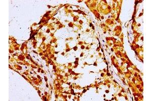 Immunohistochemistry of paraffin-embedded human testis tissue using ABIN7161727 at dilution of 1:100
