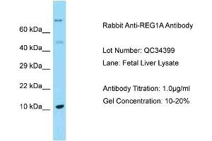 Host: Rabbit Target Name: REG1A Sample Type: Fetal Liver Antibody Dilution: 1.