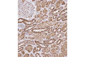 Immunohistochemistry (Paraffin-embedded Sections) (IHC (p)) image for anti-WAP Four-Disulfide Core Domain 1 (WFDC1) (AA 148-177), (C-Term) antibody (ABIN656404)