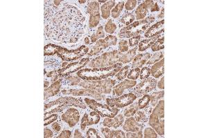 Immunohistochemical analysis of (ABIN656404 and ABIN2845698) on paraffin-embedded Human kidney tissue.