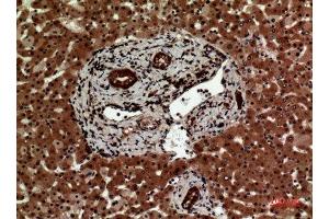 Immunohistochemistry (IHC) analysis of paraffin-embedded Human Liver, antibody was diluted at 1:100. (IL12A Antikörper  (Internal Region))