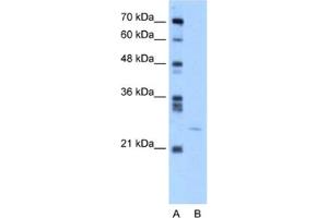 Western Blotting (WB) image for anti-YEATS Domain Containing 4 antibody (ABIN2460178) (GAS41 Antikörper)