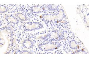 Detection of CTGF in Human Small intestine Tissue using Polyclonal Antibody to Connective Tissue Growth Factor (CTGF) (CTGF Antikörper  (AA 248-349))