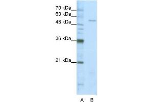 WB Suggested Anti-SARS Antibody Titration:  1. (Seryl-tRNA Synthetase (SARS) (Middle Region) Antikörper)