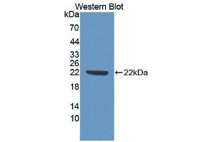 Western blot analysis of the recombinant protein. (ECT2 Antikörper  (AA 166-348))