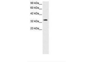 Image no. 2 for anti-PRKC, Apoptosis, WT1, Regulator (PAWR) (AA 212-261) antibody (ABIN202286) (PAWR Antikörper  (AA 212-261))