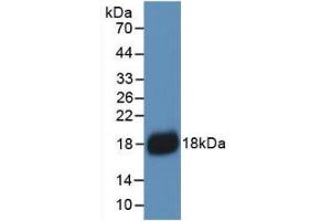 Detection of Recombinant IL18, Human using Monoclonal Antibody to Interleukin 18 (IL18) (IL-18 Antikörper  (AA 37-193))