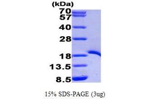 SDS-PAGE (SDS) image for TNF Receptor-Associated Factor 1 (TRAF1) (AA 266-416) protein (His tag) (ABIN667006) (TRAF1 Protein (AA 266-416) (His tag))