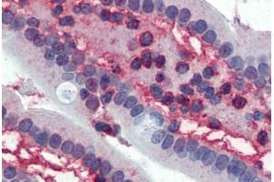 Small intestine,Human: Formalin-Fixed, Paraffin-Embedded (FFPE) (CDK1 Antikörper)