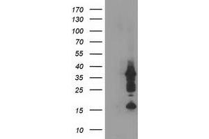 Western Blotting (WB) image for anti-PDZ and LIM Domain 2 (PDLIM2) antibody (ABIN1500123) (PDLIM2 Antikörper)