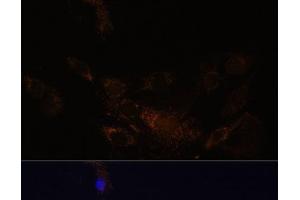 Immunofluorescence analysis of C6 cells using PSMB7 Polyclonal Antibody at dilution of 1:100 (40x lens). (PSMB7 Antikörper)