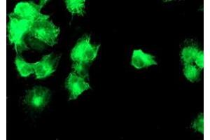 Anti-DGKA mouse monoclonal antibody (ABIN2455459) immunofluorescent staining of COS7 cells transiently transfected by pCMV6-ENTRY DGKA (RC222395). (DGKA Antikörper)