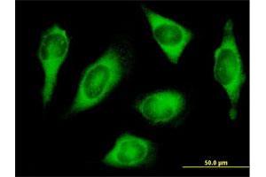 Immunofluorescence of purified MaxPab antibody to HARS on HeLa cell. (HARS1/Jo-1 Antikörper  (AA 1-509))