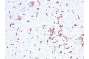 Immunohistochemistry (IHC) image for anti-Ionized Calcium-binding Adapter Molecule 1 (IBA1) (AA 1-146) antibody (ABIN6939300)