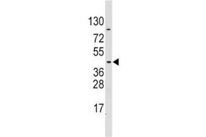 Western blot analysis of PDK4 antibody and CEM lysate (PDK4 Antikörper  (AA 250-277))