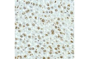 Immunohistochemistry of paraffin-embedded rat brain using NOP10 Rabbit mAb (ABIN7268953) at dilution of 1:50 (40x lens). (Nop10 Antikörper)