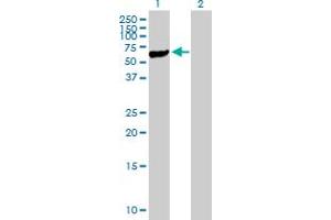 Western Blot analysis of STK40 expression in transfected 293T cell line by STK40 MaxPab polyclonal antibody. (STK40 Antikörper  (AA 1-435))