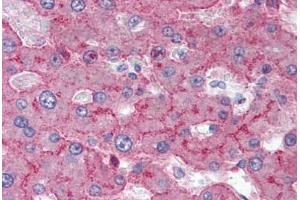 Human Liver (formalin-fixed, paraffin-embedded) stained with LRP1 antibody ABIN337070 at 5-10 ug/ml followed by biotinylated anti-mouse IgG secondary antibody ABIN481714, alkaline phosphatase-streptavidin and chromogen. (LRP1 Antikörper)