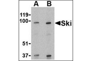 Western blot analysis of Ski in human kidney tissue lysate with this product at (A) 1 and (B) 2 μg/ml. (SKI Antikörper  (N-Term))