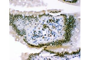 IHC analysis of p95 NBS1 using anti-p95 NBS1 antibody (ABIN3043282). (Nibrin Antikörper  (C-Term))