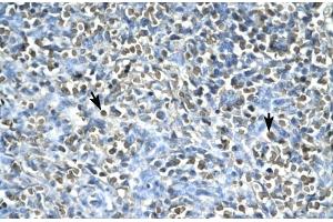 Human Spleen; ASGR2 antibody - N-terminal region in Human Spleen cells using Immunohistochemistry (Asialoglycoprotein Receptor 2 Antikörper  (N-Term))