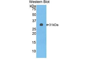 Western blot analysis of the recombinant protein. (Complement Factor H Antikörper  (AA 915-1156))