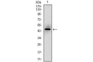 Western blot analysis using MSH6 mAb against human MSH6 (AA: 217-395) recombinant protein.