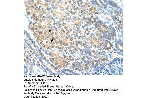 Rabbit Anti-RAD23A Antibody  Paraffin Embedded Tissue: Human Kidney Cellular Data: Epithelial cells of renal tubule Antibody Concentration: 4. (RAD23A Antikörper  (Middle Region))