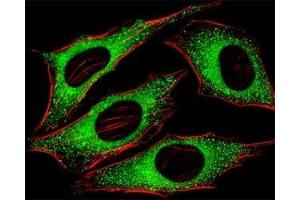 Fluorescent image of HeLa cells stained with FGFR2 antibody at 1:25 dilution. (FGFR2 Antikörper  (AA 7-37))
