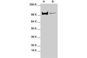 Western blot analysis of STAT2 polyclonal antibody  in expression in A-431 (A) and HeLa (B) whole cell lysates. (STAT2 Antikörper  (C-Term))
