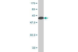 Western Blot detection against Immunogen (65. (PCBP2 Antikörper  (AA 1-362))
