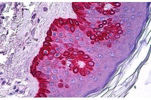 Human Skin: Formalin-Fixed, Paraffin-Embedded (FFPE) (CELA1 Antikörper)