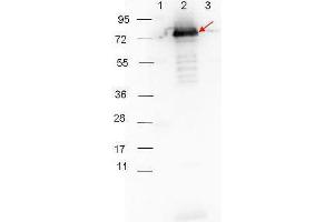 Western blot showing detection of 0. (Surface Lipoprotein p27 Antikörper)