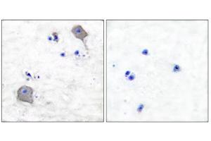 Immunohistochemical analysis of paraffin-embedded human brain tissue using Claudin 5 antibody (ABIN5976358). (Claudin 5 Antikörper  (C-Term))