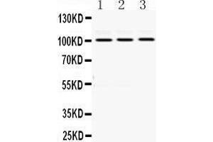 Western Blotting (WB) image for anti-RAS P21 Protein Activator (GTPase Activating Protein) 1 (RASA1) (AA 1018-1047), (C-Term) antibody (ABIN3043368)
