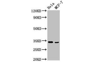 Western Blot Positive WB detected in: Hela whole cell lysate, MCF-7 whole cell lysate All lanes: NFKBID antibody at 3. (NFKBID Antikörper  (AA 1-150))