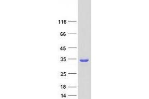 Western Blotting (WB) image for Tumor Protein D52-Like 2 (TPD52L2) (Transcript Variant 5) protein (Myc-DYKDDDDK Tag) (ABIN2734622)