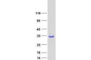 Validation with Western Blot (TPD52L2 Protein (Transcript Variant 5) (Myc-DYKDDDDK Tag))