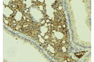 ABIN6277406 at 1/100 staining Mouse lung tissue by IHC-P. (MMP25 Antikörper  (Internal Region))
