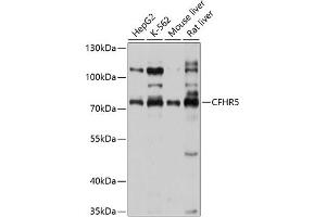 Western blot analysis of extracts of various cell lines, using CFHR5 antibody (ABIN6131938, ABIN6138459, ABIN6138460 and ABIN6214598) at 1:1000 dilution. (CFHR5 Antikörper  (AA 450-569))