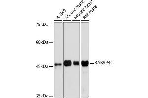 Western blot analysis of extracts of various cell lines, using RRP40 Rabbit mAb (ABIN7269816) at 1:1000 dilution. (RABEPK Antikörper)