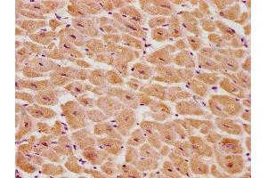 IHC image of ABIN7139700 diluted at 1:100 and staining in paraffin-embedded human heart tissue performed on a Leica BondTM system. (PSMD14 Antikörper  (Regulatory Subunit 14))
