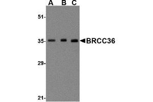 Western Blotting (WB) image for anti-BRCA1/BRCA2-Containing Complex, Subunit 3 (BRCC3) (N-Term) antibody (ABIN1031281) (BRCC3 Antikörper  (N-Term))