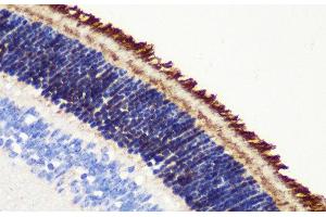 Immunohistochemistry of paraffin-embedded Mouse retina using PDE6B Polyclonal Antibody at dilution of 1:200 (40x lens).