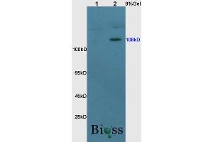 SDS-PAGE (SDS) image for anti-Nuclear Receptor Subfamily 3, Group C, Member 2 (NR3C2) (AA 601-700) antibody (ABIN735353)