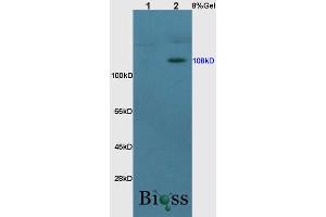 Lane 1: rat brain lysates Lane 2: rat kidney lysates probed with Anti MCR Polyclonal Antibody, Unconjugated (ABIN735353) at 1:200 in 4 °C. (NR3C2 Antikörper  (AA 601-700))