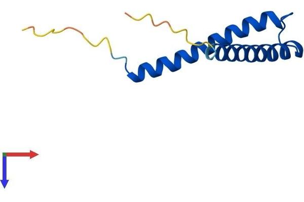 TIMM8A/DDP Protein (AA 1-97) (His tag)